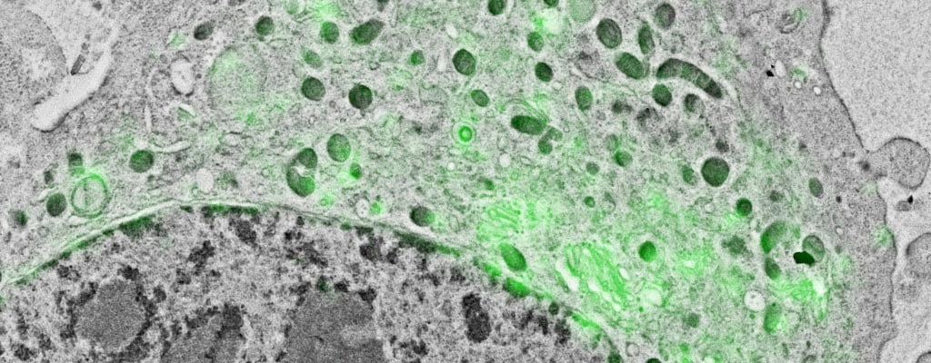 What Is Correlative Light And Electron Microscopy