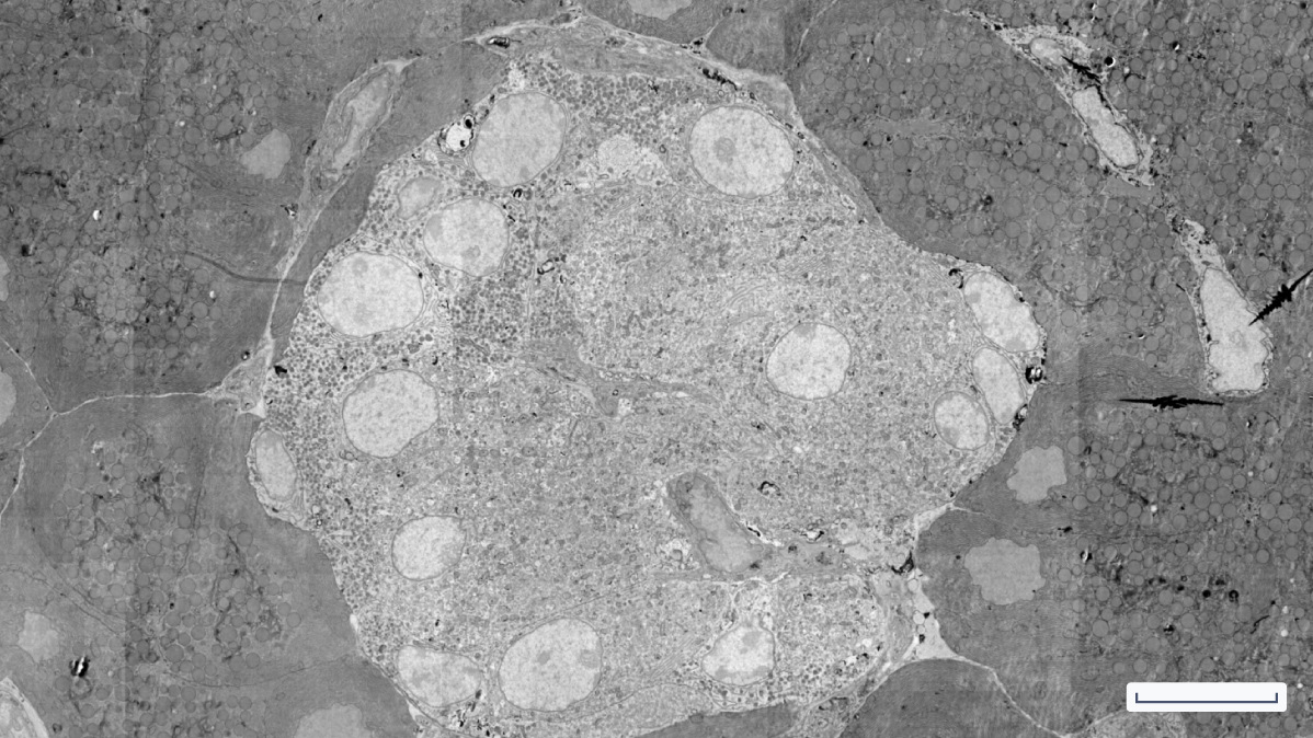 Rat-pancreas-field-image_scalebar_10um